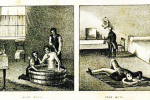 Đổ nước lên đầu người bệnh để chữa bệnh tâm thần ở thế kỷ 19